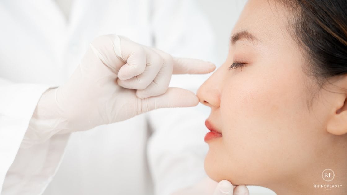 Rhinoplasty Surgery