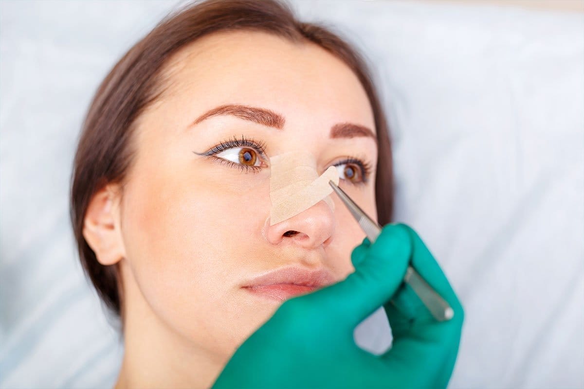 What Can You Not Do After Rhinoplasty?