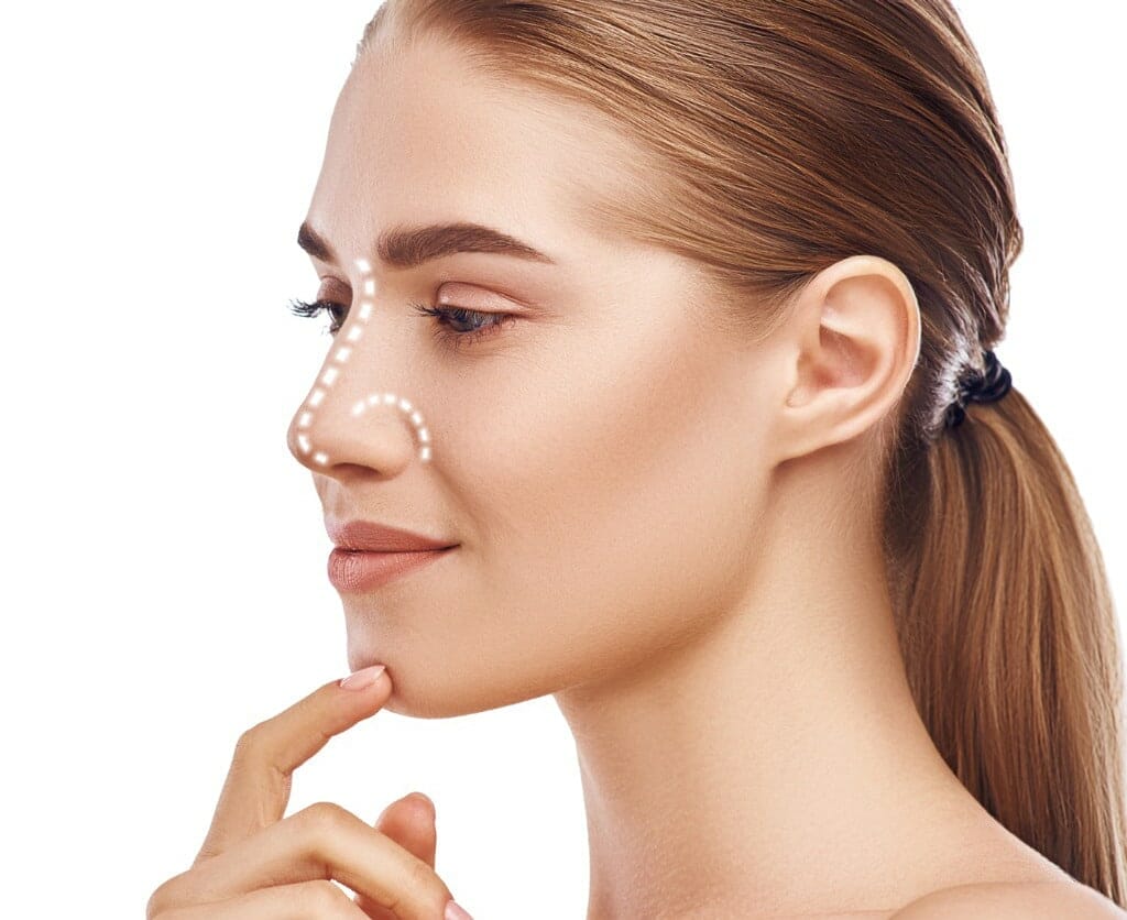 Nose Job Cost In UK How Much Is a Nose Job in the UK